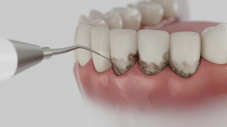 Reliable Dental Implants contractor in Summit View, WA by Smile Center Dentistry